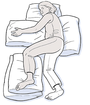 Woman lying on side unaffected by stroke with pillows supporting back, head, arm, and unaffected leg.