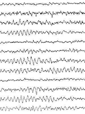 Twelve parallel lines showing normal EEG waveforms. Lines are regular, repeating pattern of small peaks and valleys.