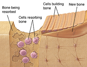 Diagram of normal bone growth showing three different types of bone cells.