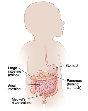 Outline of baby showing digestive tract and Meckel's diverticulum.