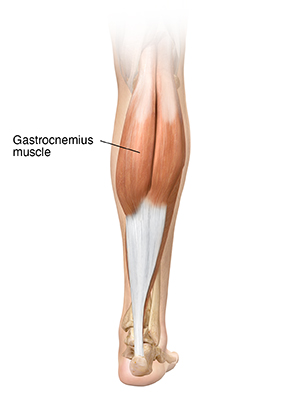 Back view of lower leg showing gastrocnemius muscle.