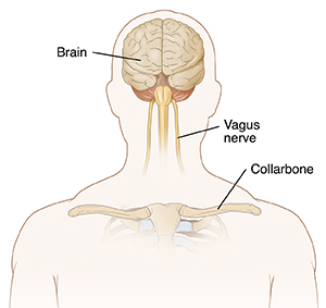 Front view of man's head and chest showing brain and vagus nerves.