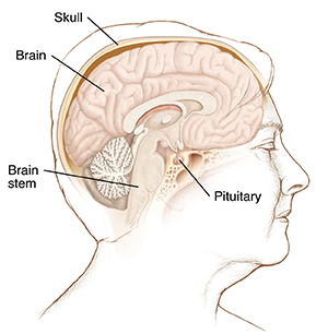 Side view of woman's head showing brain, pituitary gland, brain stem, and skull.