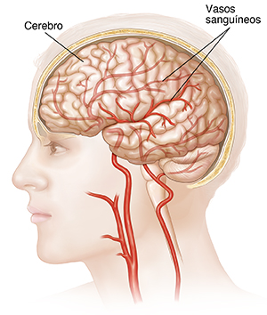 Vista lateral de una cabeza, el cerebro y los vasos sanguíneos que van hacia el cerebro.