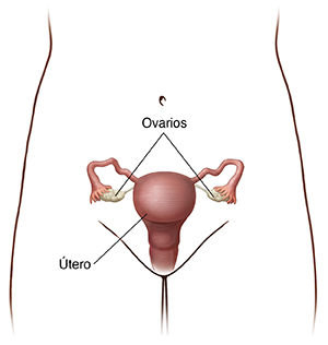 Vista frontal de la pelvis de una mujer donde se observa el útero y los ovarios.